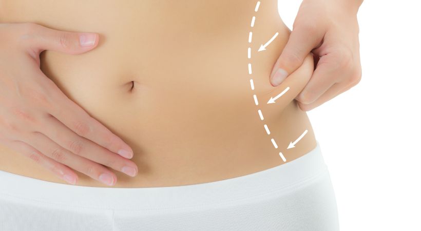 ما قبل عملية شفط الدهون والتحضيرات اللازمة