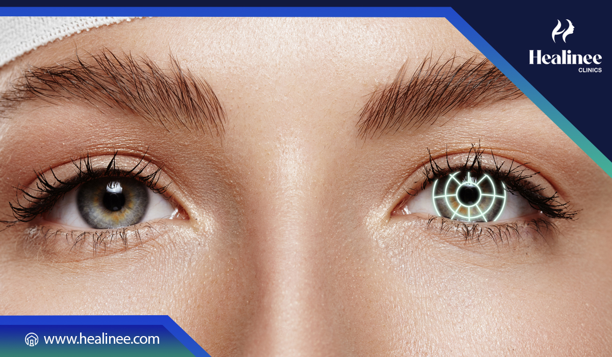 هل يمكن إعادة عملية الليزك؟ (عمليات التصحيح المتكررة) في تركيا